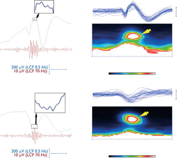 Electroencephalography (EEG) device.