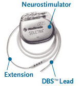 Different parts of DBS