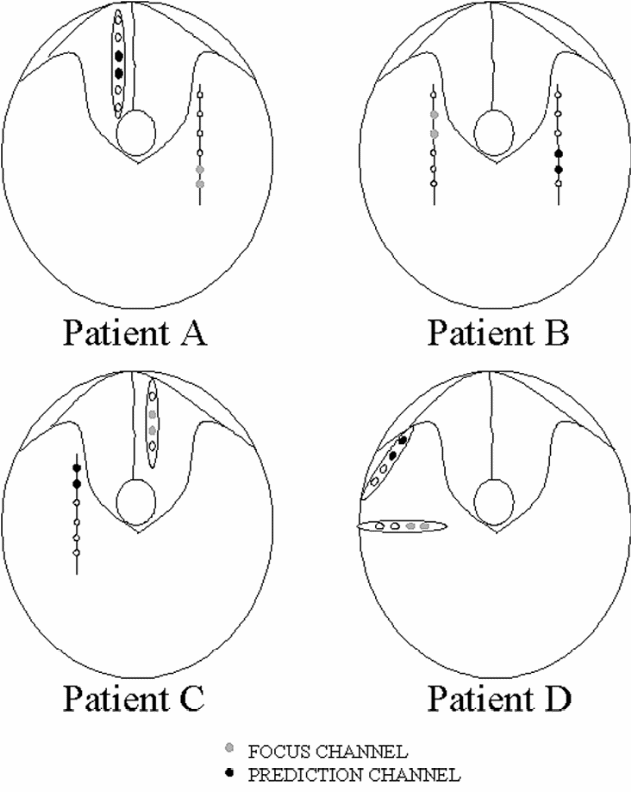 Analysis of the theta brainwaves