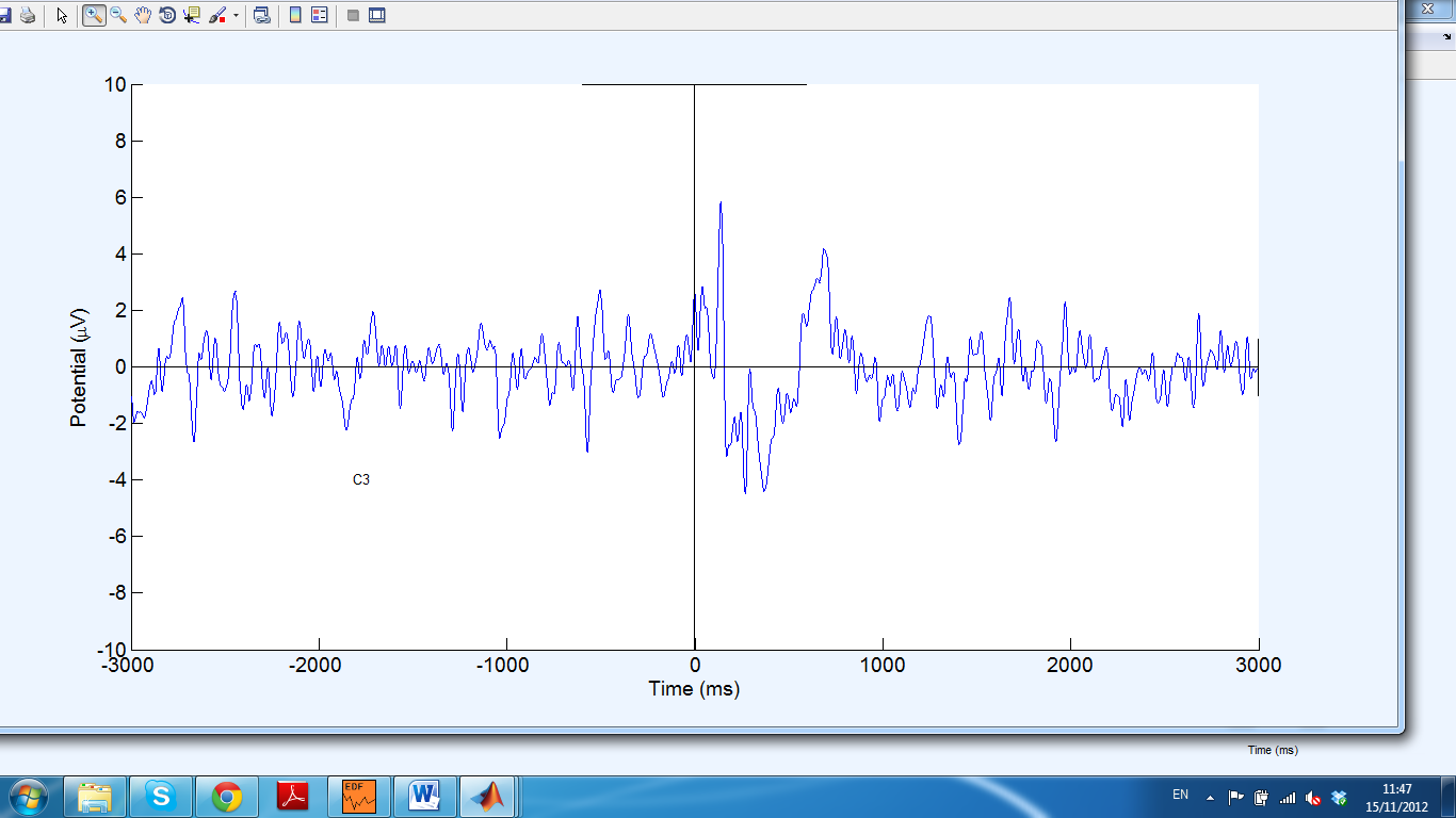 From channels C3 and C4 a negative peak is observed after the onset