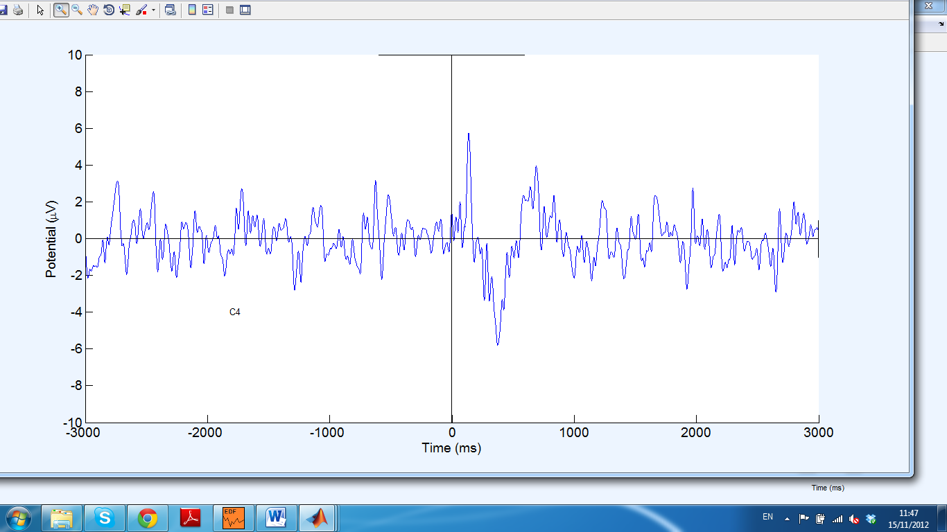 From channels C3 and C4 a negative peak is observed after the onset
